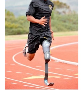 Sprinting Prosthesis